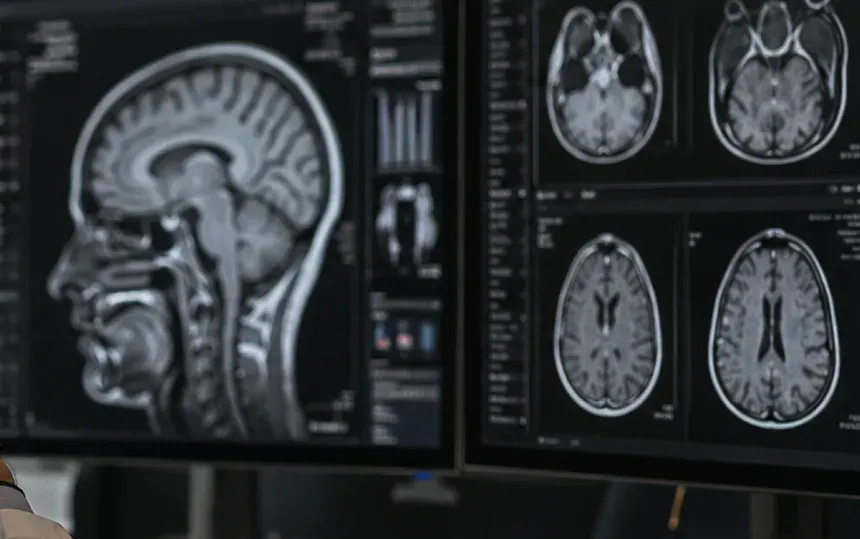Brain scans on a monitor